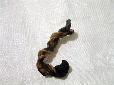 umbilical cord