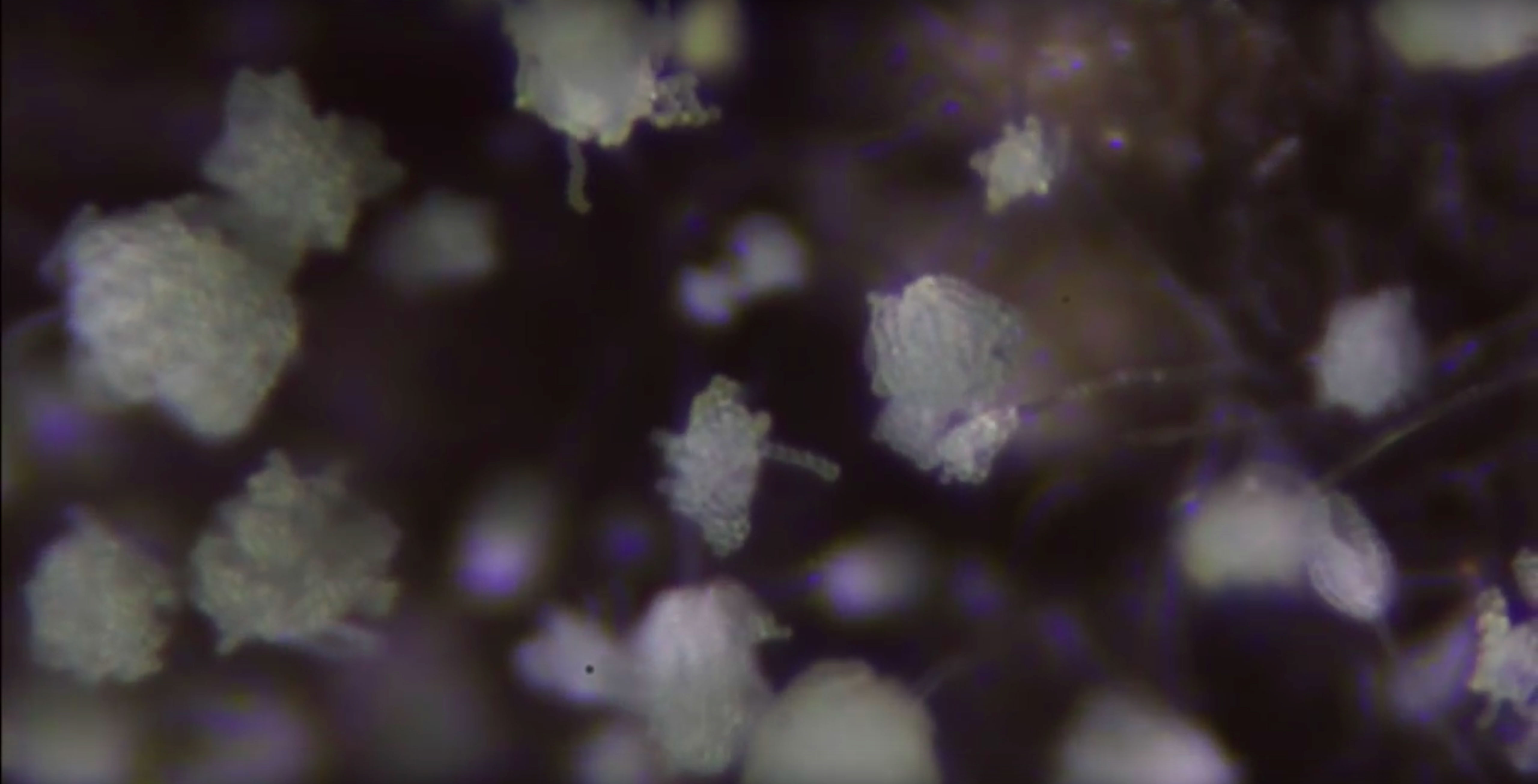 Microphotography of mold spores