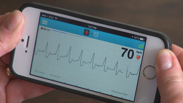 AliveCor is the maker of a smartphone case that can record within seconds an EKG, a measure of heart health.