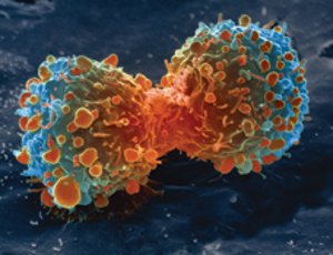 Each cancer cell is like a snowflake, totally unique.  Scientists can exploit this uniqueness to trea cancer (Wikimedia Commons)