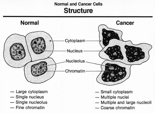 Cancer cells have mutated into something foreign our bodies can be trained to attack. (Wikimedia Commons)
