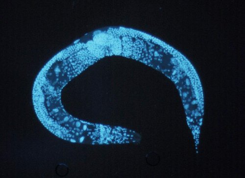 It took just a few, small genes to make this little roundworm live four times as long as it normally would. Maybe we can find something similar in people. (Wikimedia Commons)