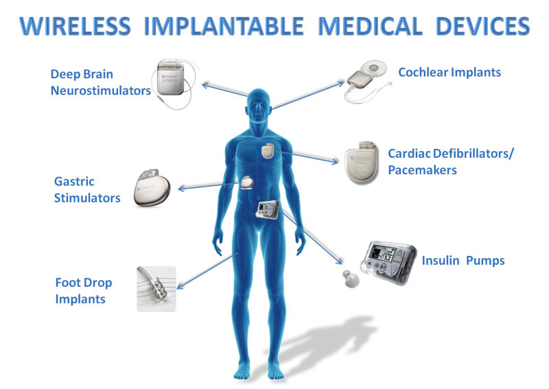 Many there are many implantable medical devices on the market that have vulnerabilities, in fact, the Food and Drug Administration has received approximately 56,000 reports of adverse events associated with the use of infusion pumps, including numerous injuries and deaths. 