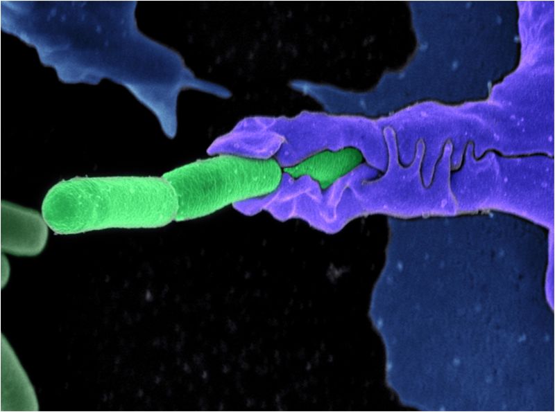 Anthrax bacteri (green) being enveloped by an immune system cell (purple). 