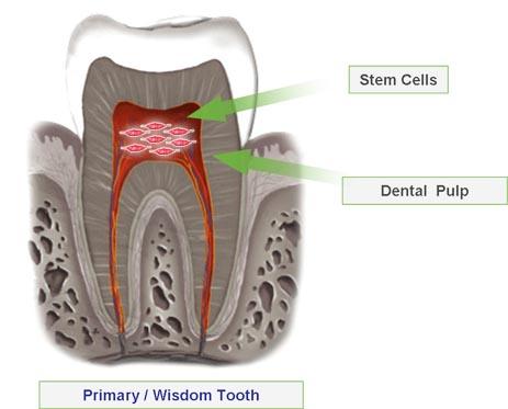 the students used dental pulp stem cells from excised wisdom teeth to create new tissue. 