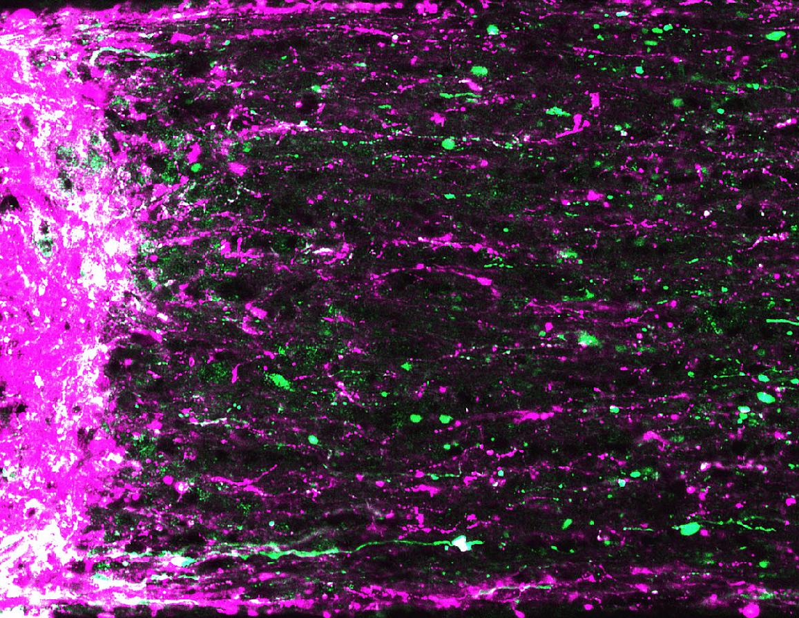 Mouse retinal ganglion cell axons (magenta and green) are regenerating, extending from site of the optic nerve injury (left). 