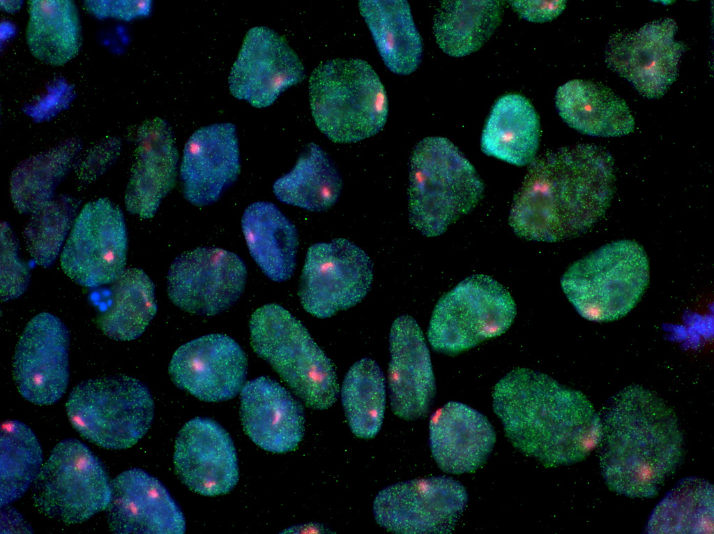 These induced pluripotent stem cells were derived from a woman's skin. Blue shows nuclei. Green shows a protein found in iPS cells but not in skin cells. The red dots show the inactivated X chromosome in each cell. 