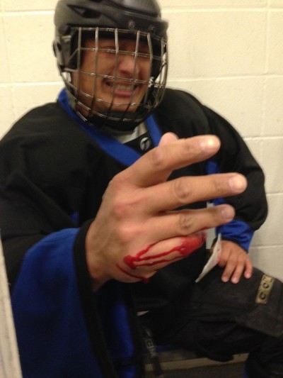 Damon Doe took a frozen puck to his pinkie finger, almost slicing it off.