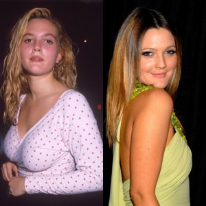 Celebrity breast reductionist: Drew Barrymore