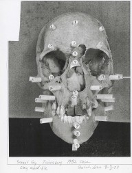 Twinsburg, Ohio John Doe skull
