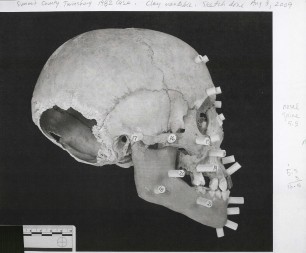 Twinsburg, Ohio John Doe skull (profile)