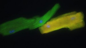 Mouse heart muscle cells created by Gladstone Institutes researchers.