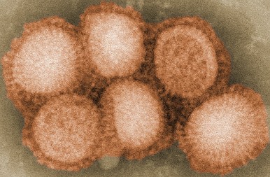 H1N1 viruses