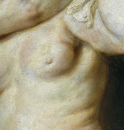 breast cancer in Rubens