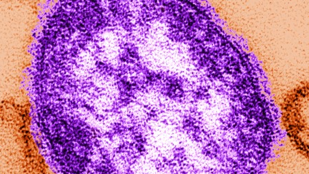 measles virus virion
