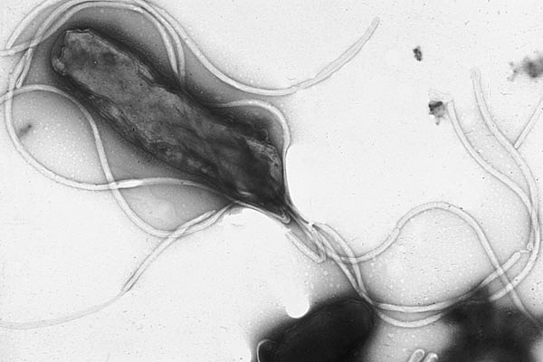 H. pylori has lived in our stomachs for 200,000 years. (Photo: Yutaka Tsutsumi)