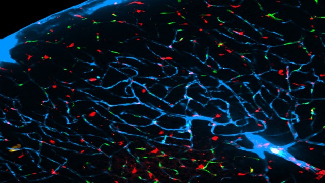 This photograph shows cerebrospinal fluid (in blue) rinsing toxins from the brain of a sleeping mouse.