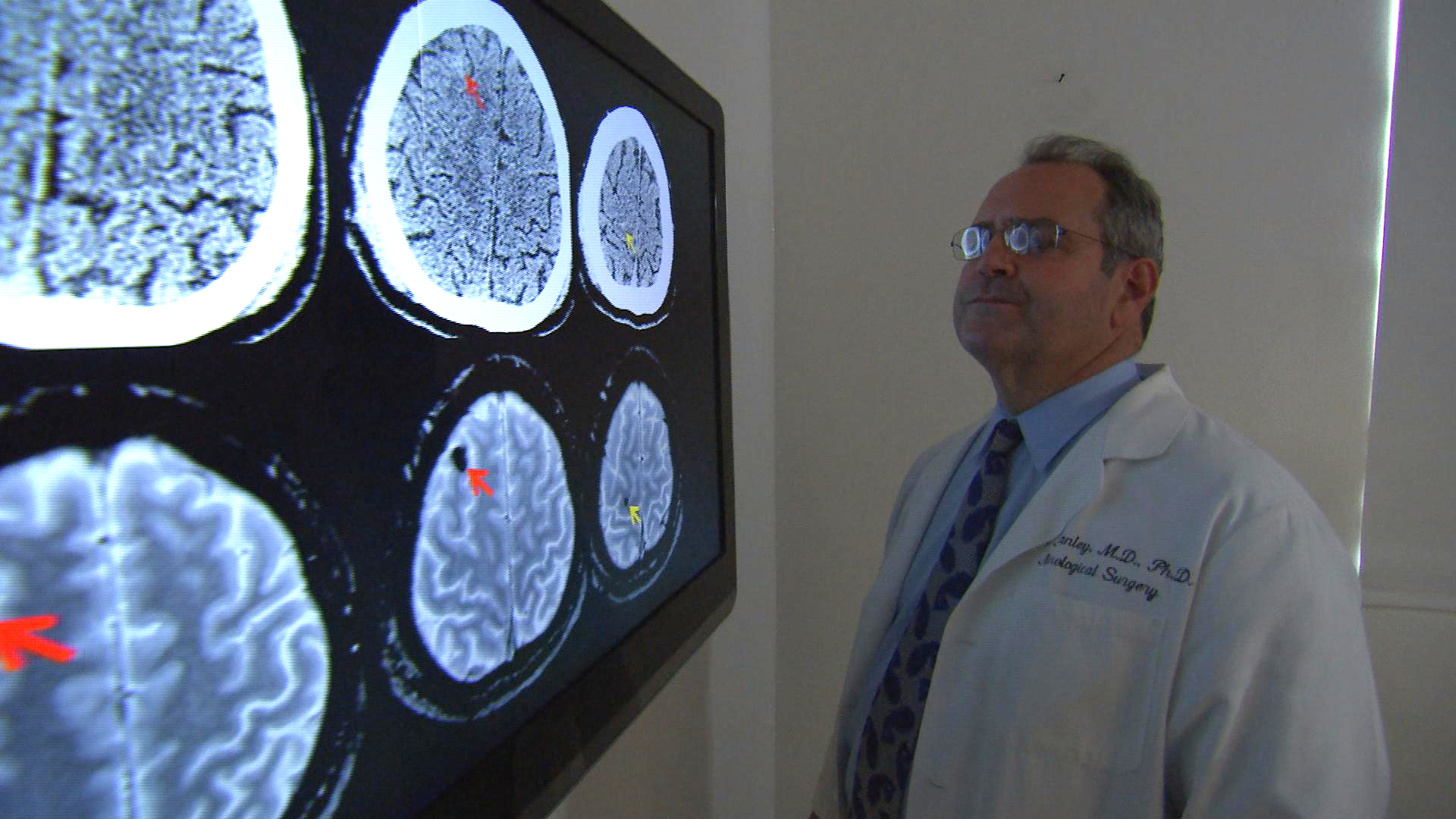 Dr. Geoffrey Manley looks at CT and MRI scans at the Brain and Spinal Injury Center in San Francisco. 