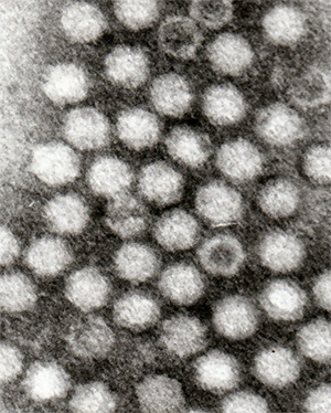 Viruses like these (AAV) could one day be used to fix the broken genes of patients with DMD (Wikimedia Commons)
