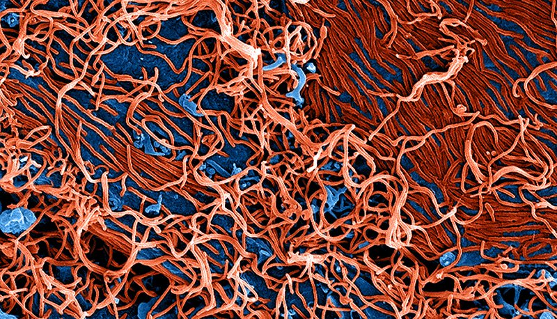 A new mouse model for Ebola may help to speed up the discovery of new treatments. (Flickr)
