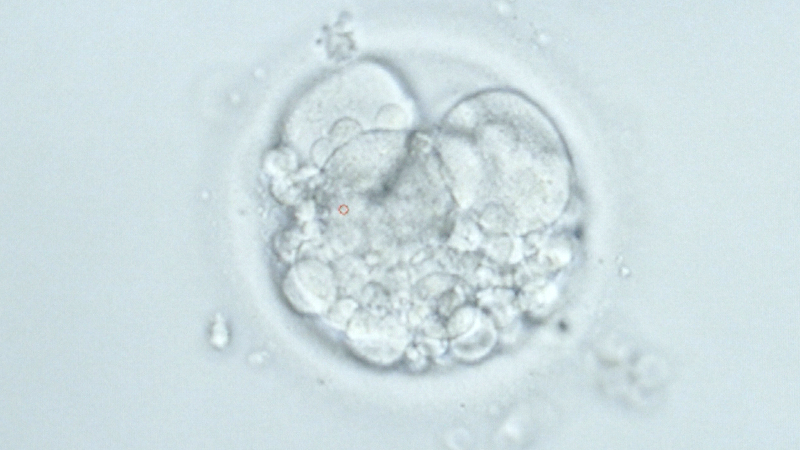 This human embryo three days after fertilization shows signs of “fragmentation,” a phenomenon that makes it less likely to continue growing. While healthy embryos look like a little bunch of grapes, with cells of the same size, this one has developed tiny fragments. (Josh Cassidy/KQED)