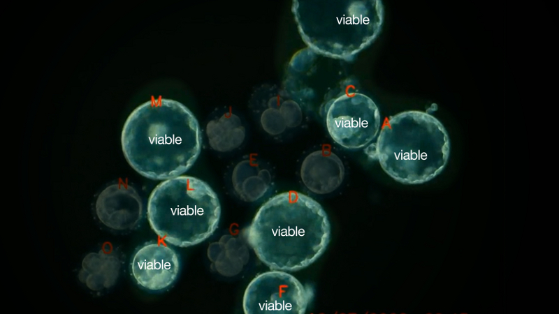 By examining time-lapse videos of developing embryos, like the one this still came from, Stanford University scientists discovered in 2010 that the embryos that made it to day five had followed a precisely timed pattern. (Wong et al, Nature Biotechnology, 2010)