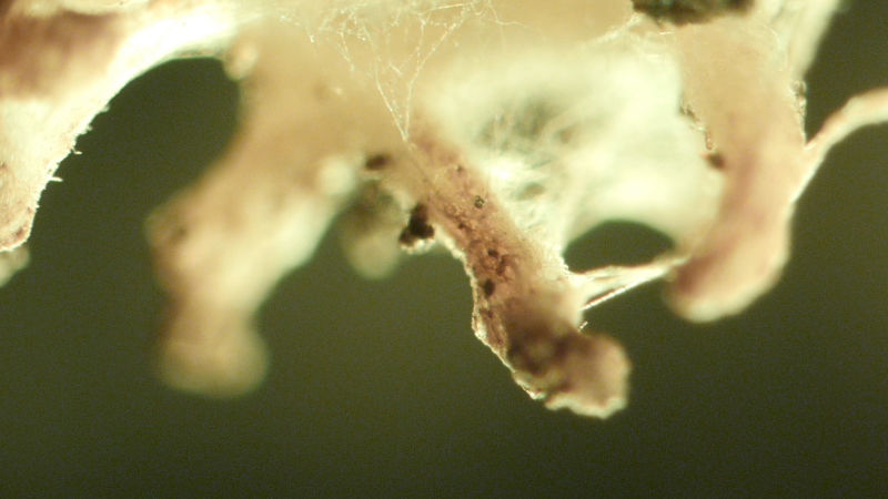 Under the microscope, white filaments of death cap fungus are seen wrapped around a tree’s thin, pink root tips. In California, death cap fungi feed on the sugars of coast live oaks and pines and give them nutrients in exchange.