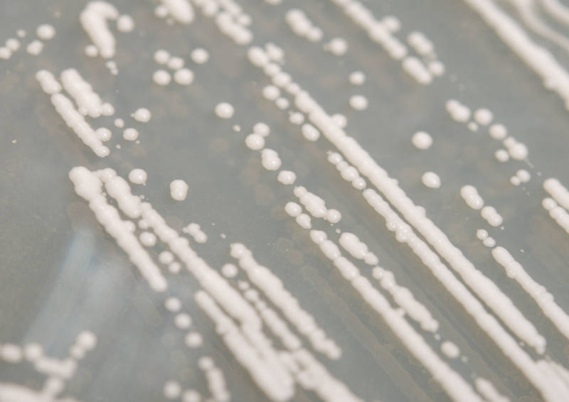 Colonies of yeast growing on a petri dish.
