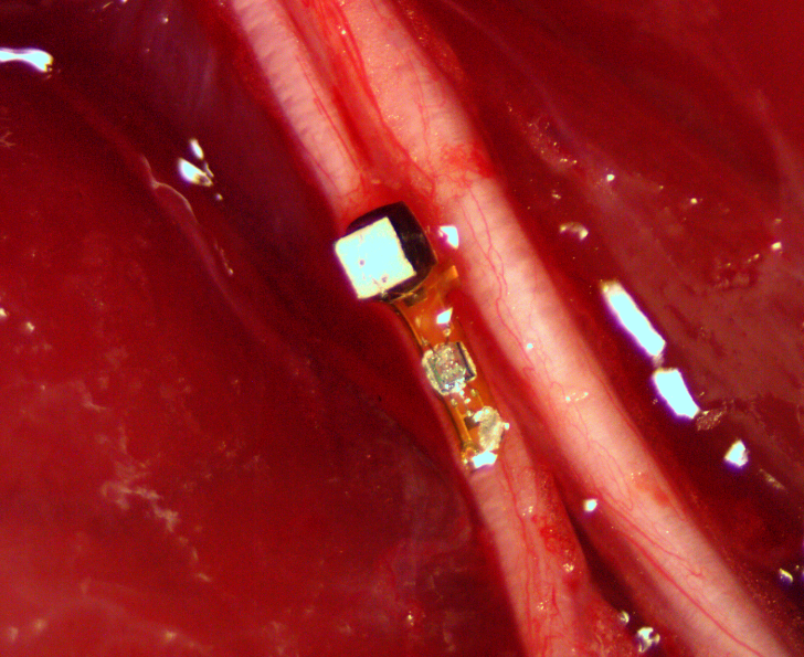 Peripheral nerve of a lab rat that has a neural dust implant. Called a 'neural mote' this implant can sense electrical activity of target neurons in the body.