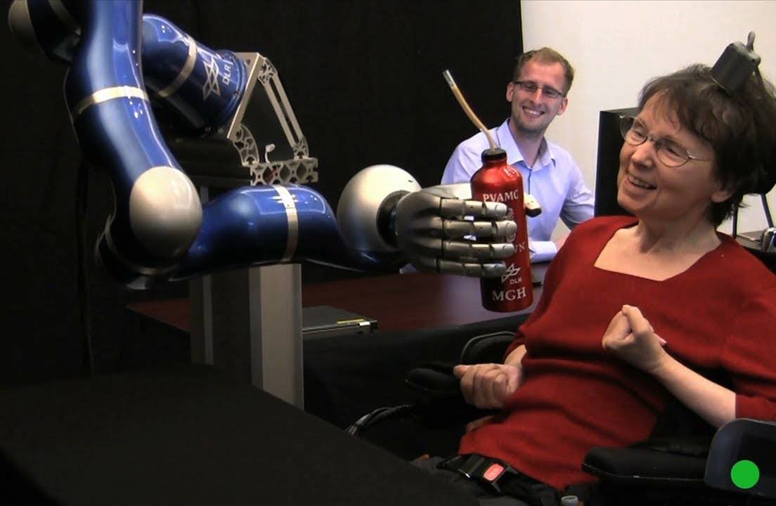 Cathy Hutchinson, a woman who is completely paralyzed, practices moving a robotic arm with her mind. She's communicating through the box on the top of her head, which has been implanted in her brain.