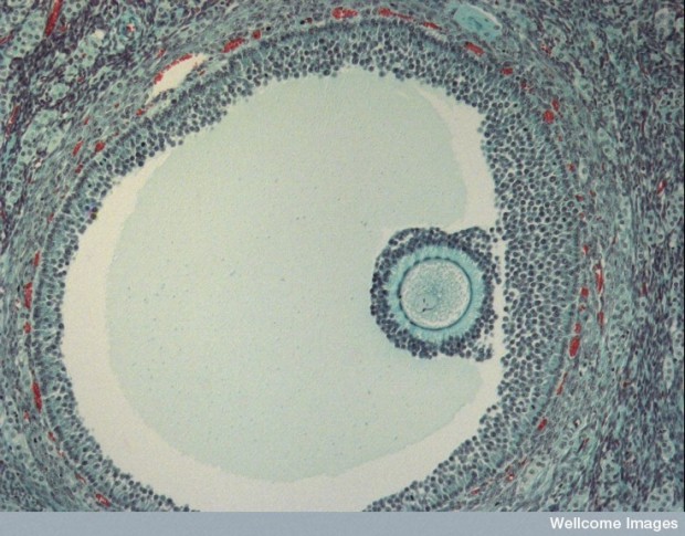 Human egg in a follicle. (Ivor Mason, KCL, Wellcome Images via Flickr)