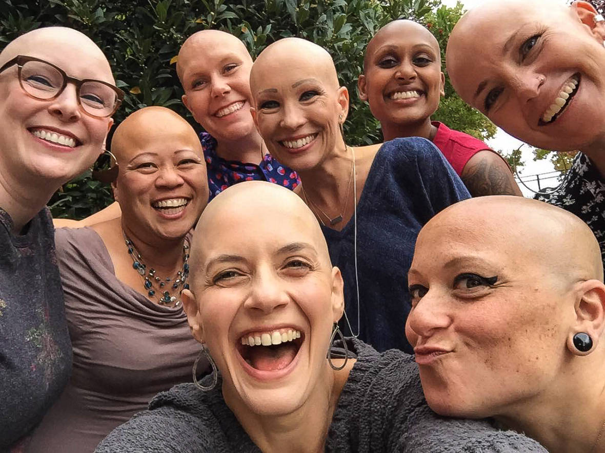 Bay Area Bald Girls: It's Not 'Just Hair' | KQED