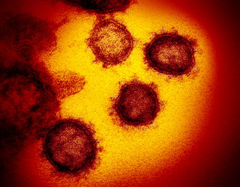 A microscopic image of the virus that causes COVID.