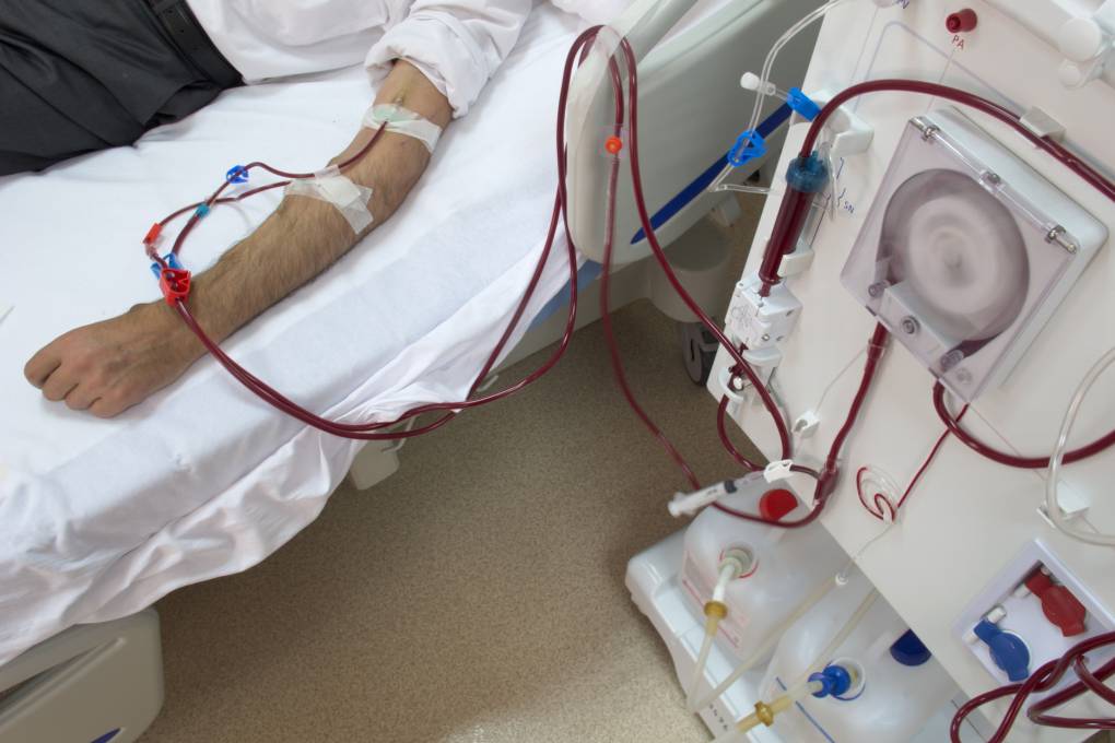 An arm is hooked up to tubing connected to a machine. Blood runs in the tubes.