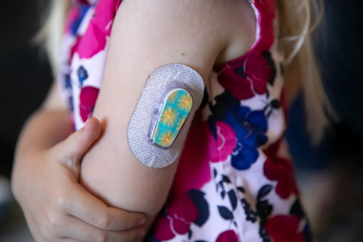 A close up shot of a little girl's arm with an insulin patch. She's wearing a pink and purple floral dress.