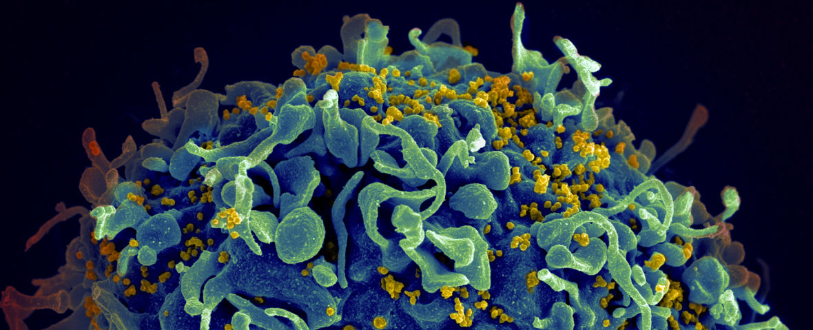 HIV, shown in yellow, infecting a human T cell. Seth Pincus, Elizabeth Fischer and Austin Athman/NIH