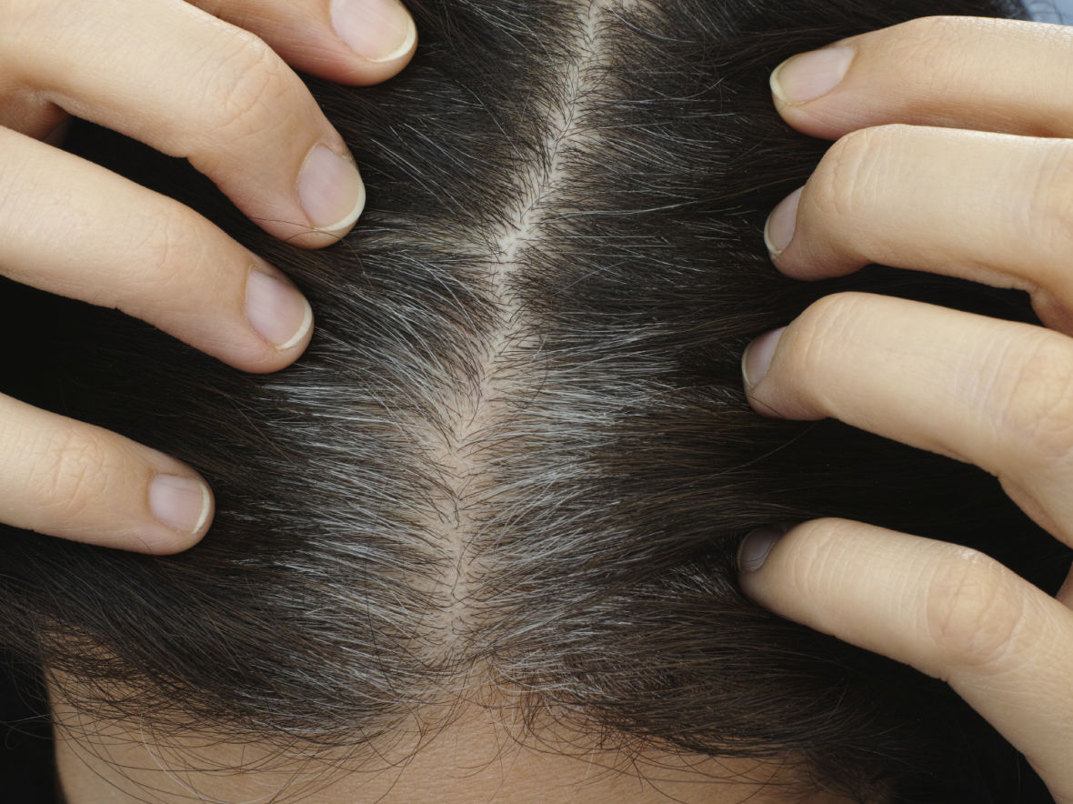 The Roots of Gray Hair Are Sometimes Genetic | KQED