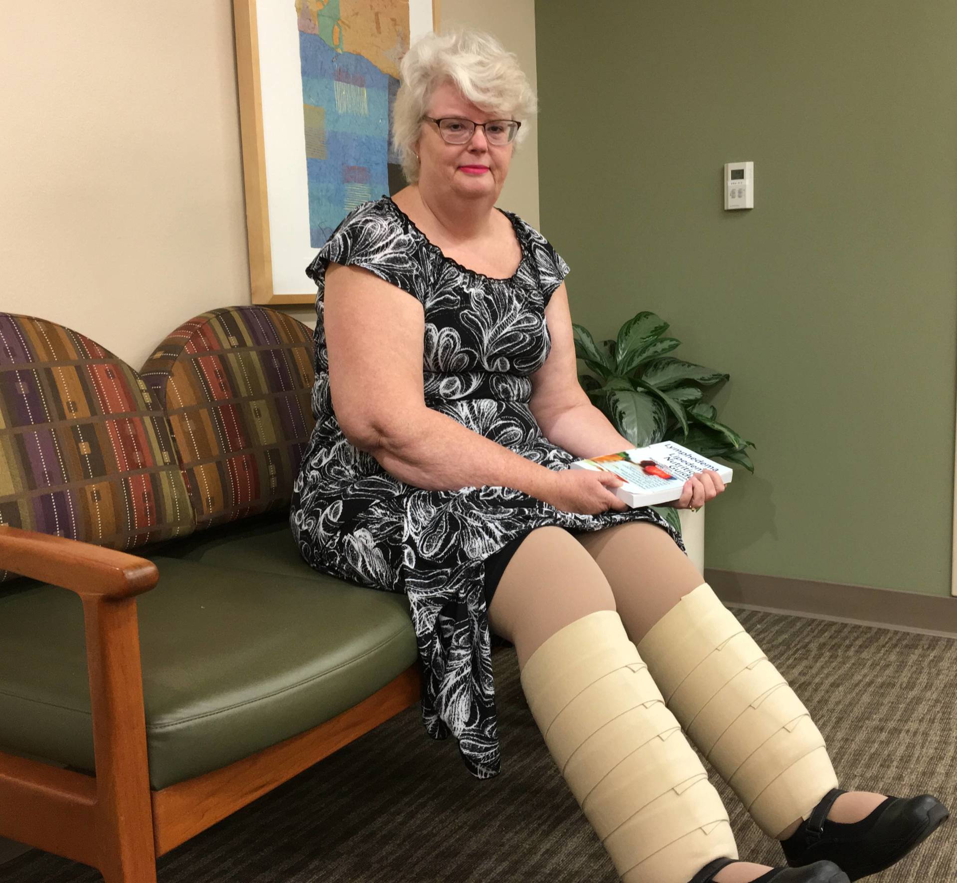 Lipedema: The Fat Disorder That Millions Have But No One Has Heard