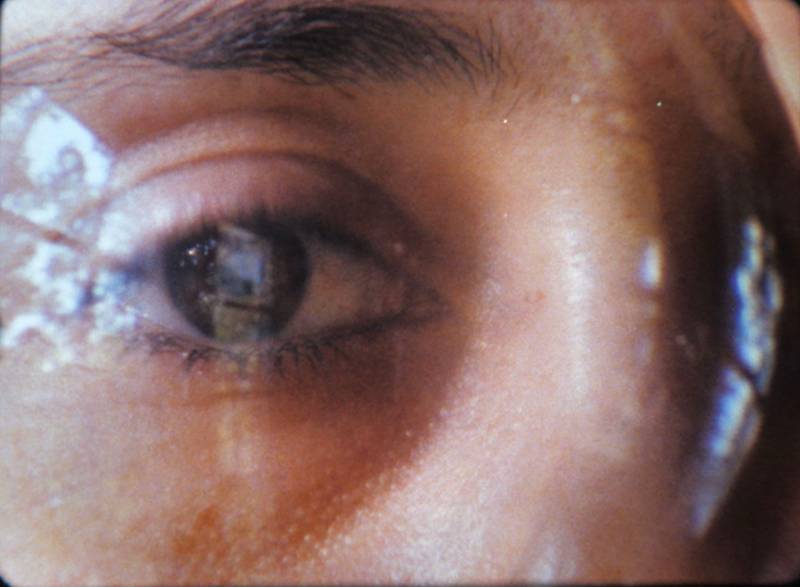 Close-up view of one eye.