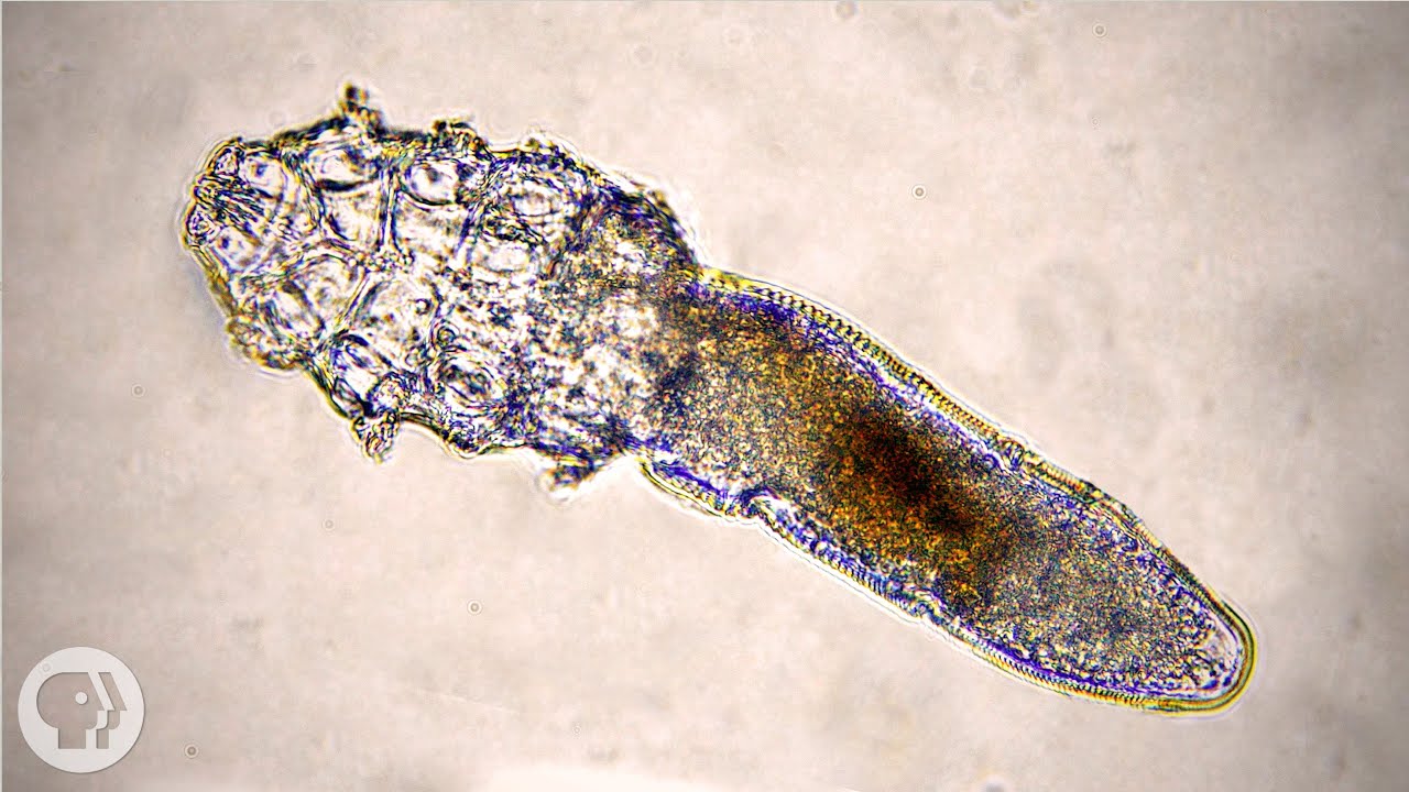 These Face Mites Really Grow on You | KQED