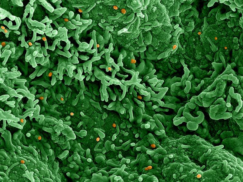 An image from an electron microscope shows small orange dots - the monkeypox virus - dotting grass-green tentacles, representing infected cells.