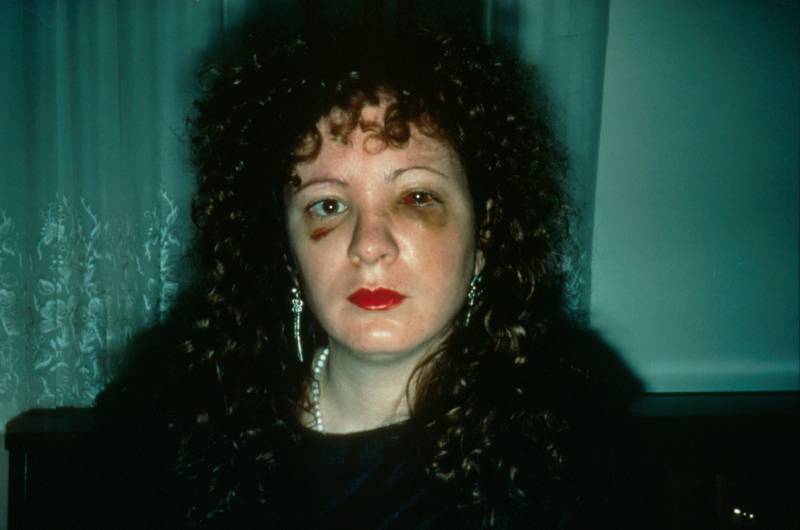 Nan Goldin, "Nan one month after being battered," 1984.