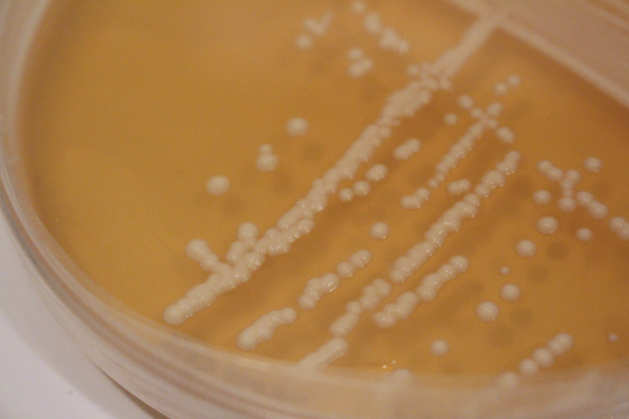 Colonies of yeast that are capable of making sour beer grow in a Petri dish.