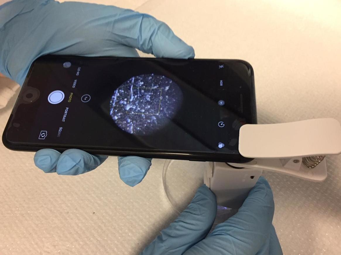 To detect bacteria, a microscope attachment clips right on to the phone's camera.