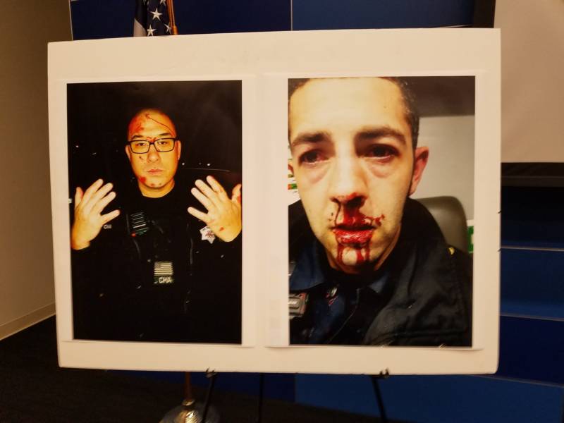 Photographs of SFPD officers Kenneth Cha and Colin Patino following their Jan. 6 encounter with Sean Moore as displayed at a Police Department press conference on Jan. 18.