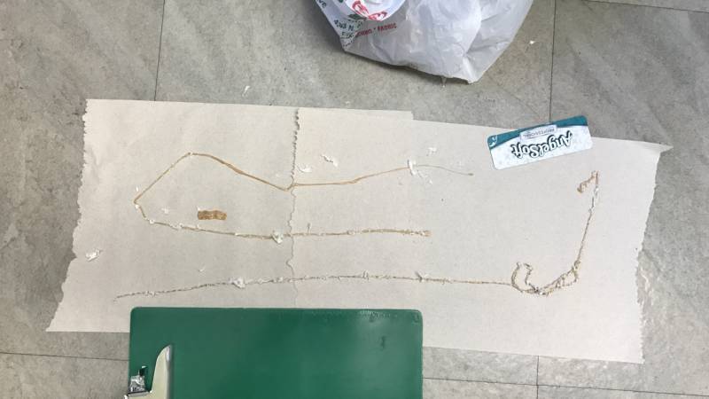 Tapeworm laid out on paper at the hospital