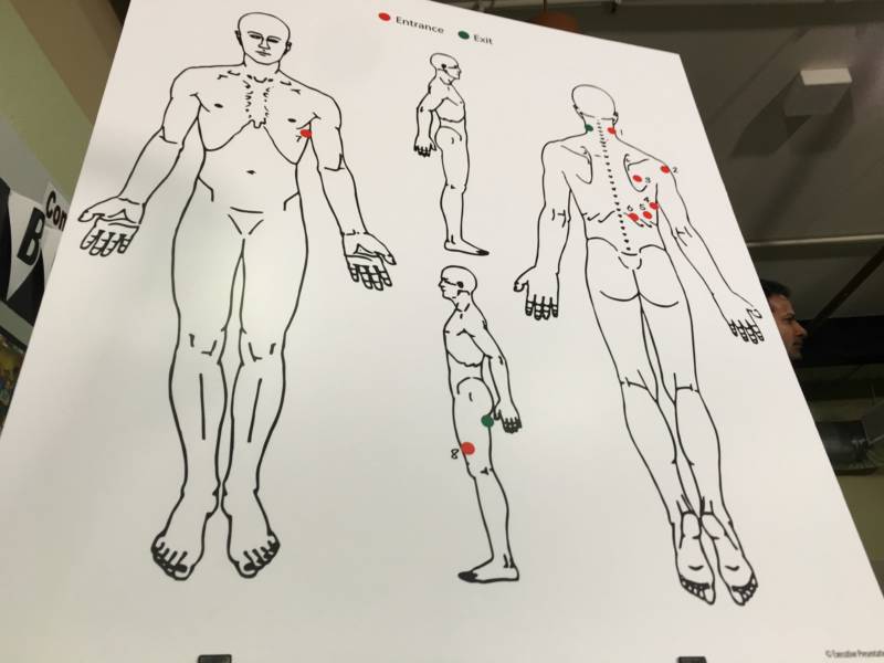 An independent autopsy rendering of Stephon Clark’s gunshot wounds.