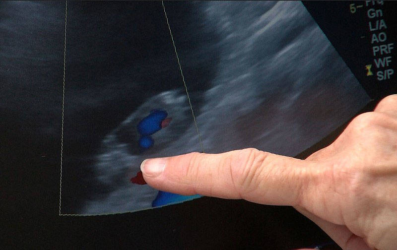 An ultrasound photo of the rhino embryo at the San Diego Zoo Safari Park on May 14, 2018.